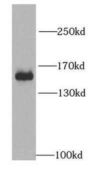 MYBBP1A Rabbit Polyclonal Antibody
