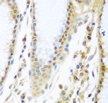 MYBBP1A Rabbit Polyclonal Antibody