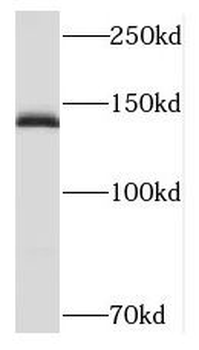 MYBPC1 Rabbit Polyclonal Antibody