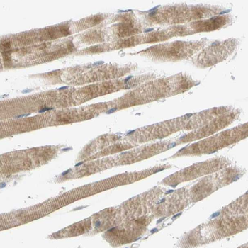 MYBPC1 Rabbit Polyclonal Antibody