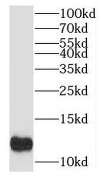 MYCBP Rabbit Polyclonal Antibody