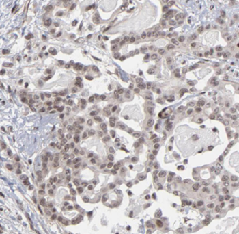 MYCBP Rabbit Polyclonal Antibody