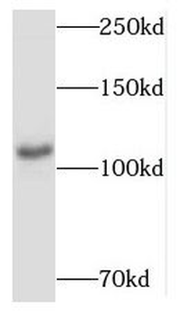 MYCBPAP Rabbit Polyclonal Antibody