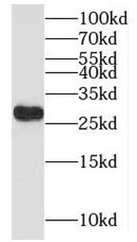 MYCT1 Rabbit Polyclonal Antibody