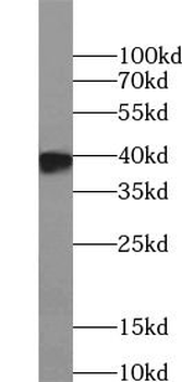 MYC tag Rabbit Polyclonal Antibody