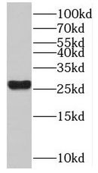 MYF6 Rabbit Polyclonal Antibody