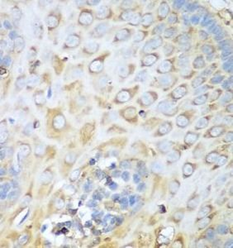 MYH9 Rabbit Polyclonal Antibody