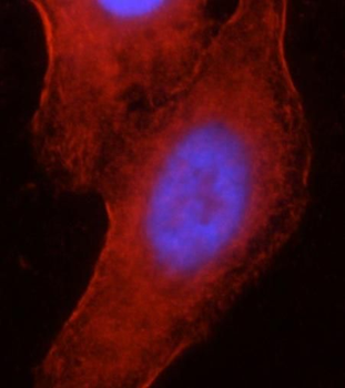 MYH9 Rabbit Polyclonal Antibody