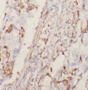 MYH9 Rabbit Polyclonal Antibody