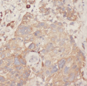 MYH9 Rabbit Polyclonal Antibody