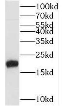MYL12B Rabbit Polyclonal Antibody