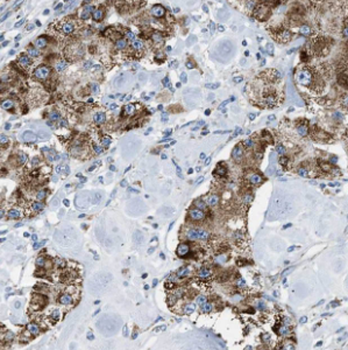 MYL12B Rabbit Polyclonal Antibody