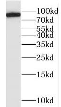MYLK3 Rabbit Polyclonal Antibody