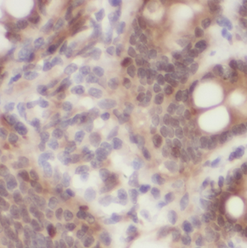 MYLK3 Rabbit Polyclonal Antibody