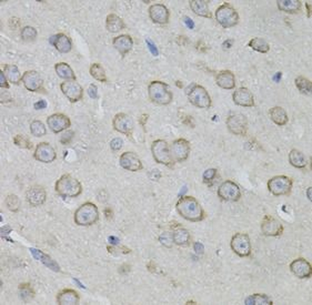 MYO10 Rabbit Polyclonal Antibody