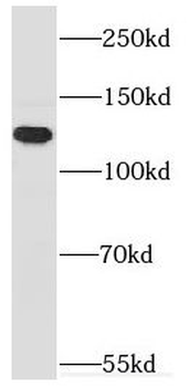 MYO1E Rabbit Polyclonal Antibody