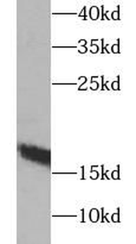 MB Rabbit Polyclonal Antibody