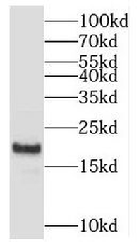 MYL2 Rabbit Polyclonal Antibody