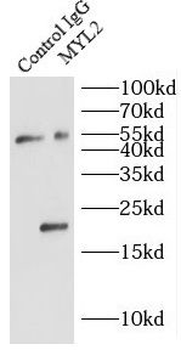 MYL2 Rabbit Polyclonal Antibody