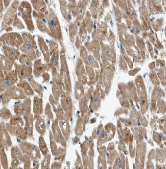 MYL2 Rabbit Polyclonal Antibody