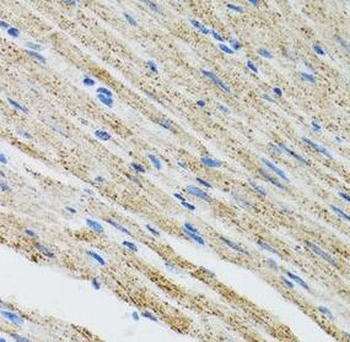 MYOT Rabbit Polyclonal Antibody