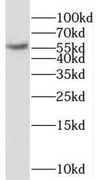 NAB2 Rabbit Polyclonal Antibody