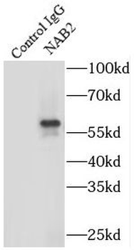 NAB2 Rabbit Polyclonal Antibody