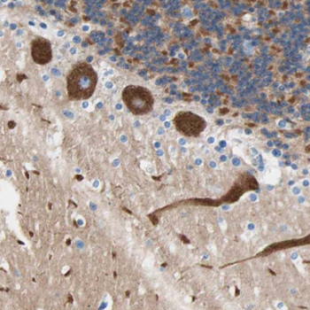 NAB2 Rabbit Polyclonal Antibody