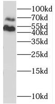 NAGA Rabbit Polyclonal Antibody