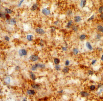 NAGA Rabbit Polyclonal Antibody