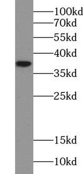 NAGK Rabbit Polyclonal Antibody