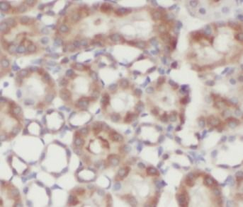NAGK Rabbit Polyclonal Antibody