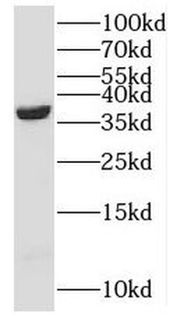 NANS Rabbit Polyclonal Antibody