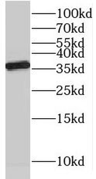 NAPB Rabbit Polyclonal Antibody