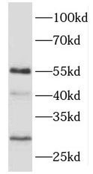 CIAO3 Rabbit Polyclonal Antibody