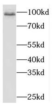 NAA16 Rabbit Polyclonal Antibody