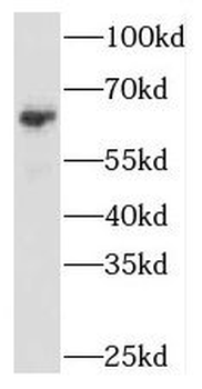 NARS1 Rabbit Polyclonal Antibody