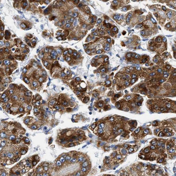 NARS1 Rabbit Polyclonal Antibody