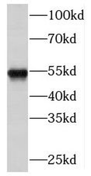 NARS2 Rabbit Polyclonal Antibody