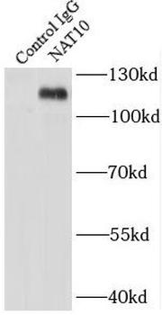 NAT10 Antibody
