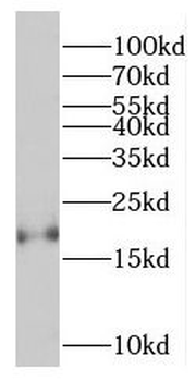 NCALD Rabbit Polyclonal Antibody