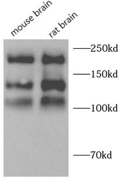 NCAM1 Antibody