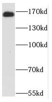 NCAPD3 Rabbit Polyclonal Antibody