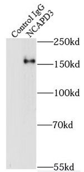 NCAPD3 Rabbit Polyclonal Antibody