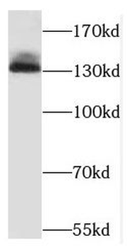 NCAPG Rabbit Polyclonal Antibody