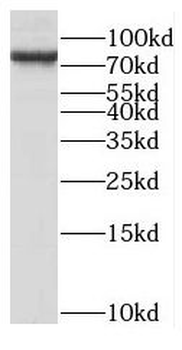 NCAPH Rabbit Polyclonal Antibody
