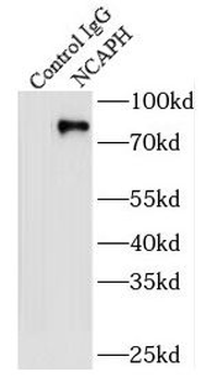NCAPH Rabbit Polyclonal Antibody