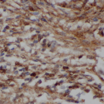 NCAPH Rabbit Polyclonal Antibody