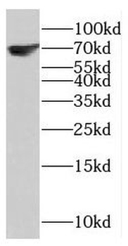 NCAPH2 Rabbit Polyclonal Antibody