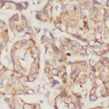 NCK1 Rabbit Polyclonal Antibody